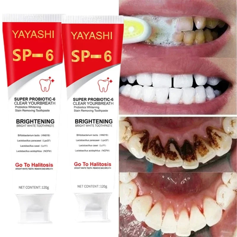 Probiotic Whitening Toothpaste With SP-6 Removes Plaque and Stains for Clean Fresh Breath